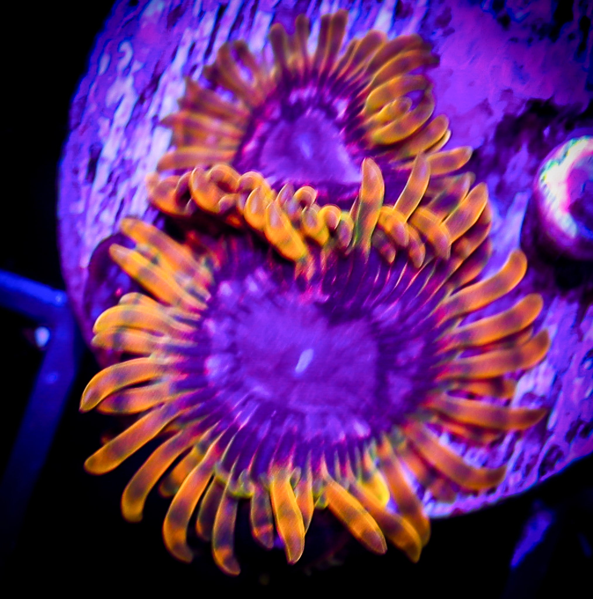 ACID REFLUX ZOA